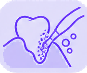 1788502478634716.png 清洁牙龈线菌斑.png